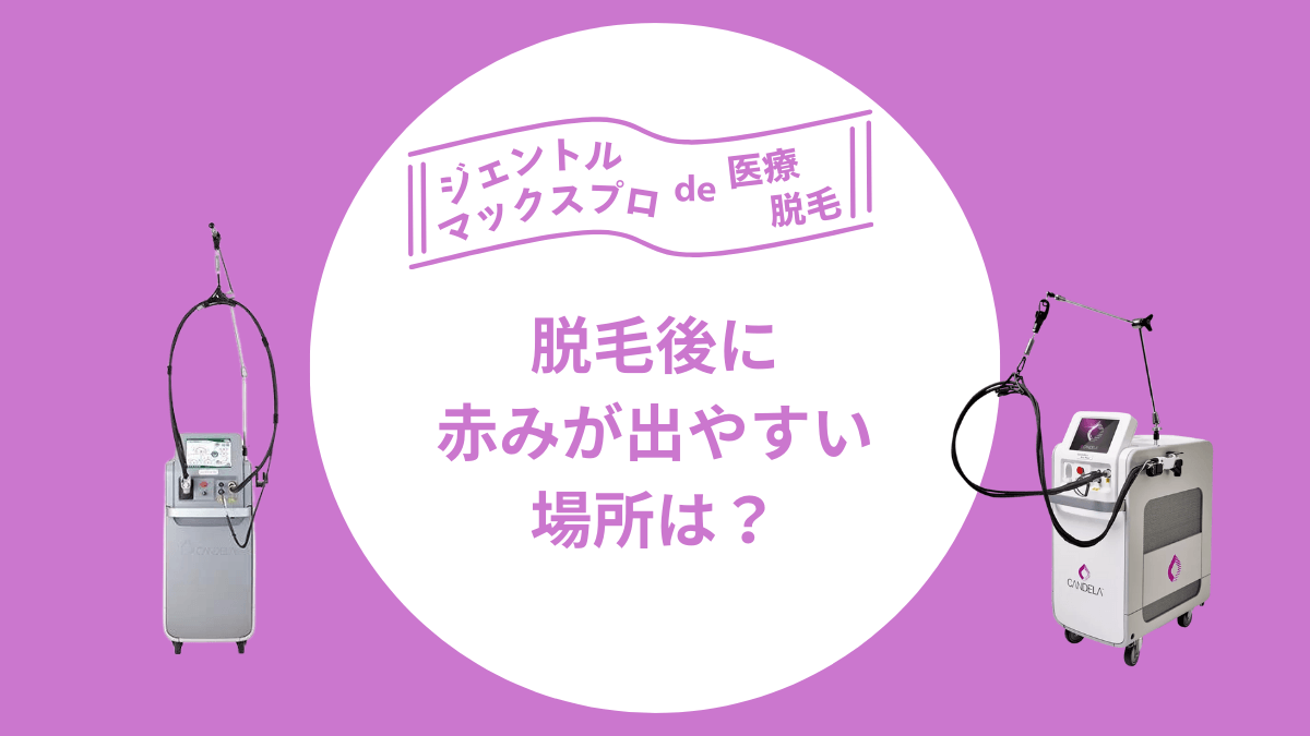 脱毛後に赤みが出やすい場所って？予防法も解説