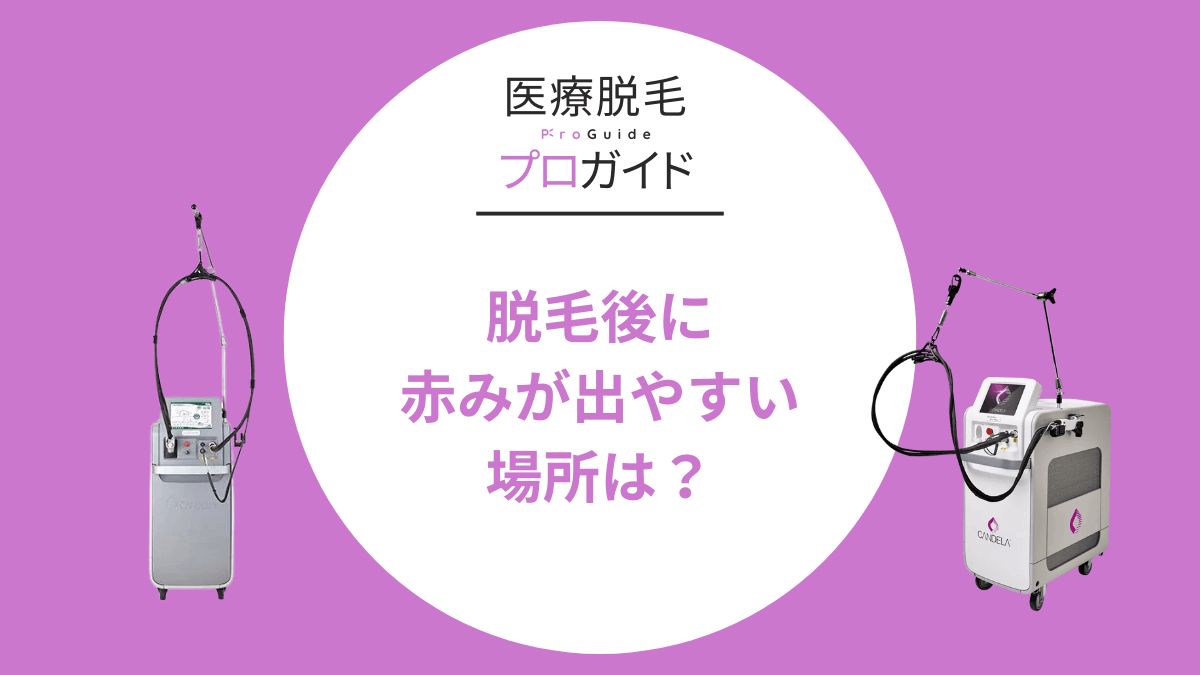 脱毛後に赤みが出やすい場所って？予防法も解説